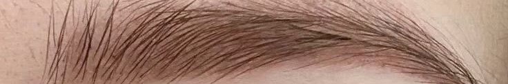 Powder brow between days fifteen and thirty-five as colour resurfaces