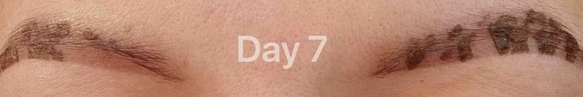 Powder brows during days four to seven of healing, showing natural flaking